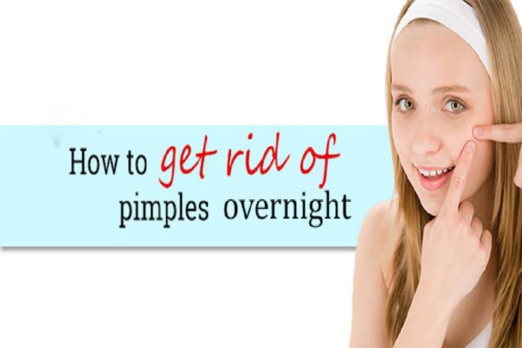 how to get rid of a pimple overnight